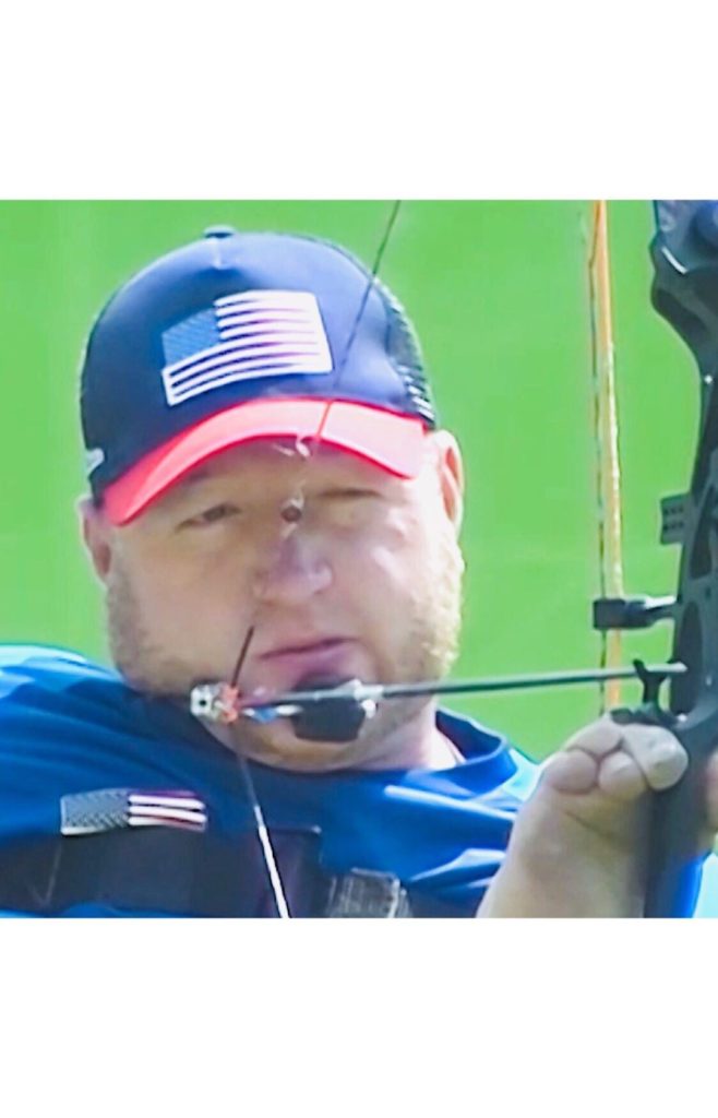 Matt Stutzman is an American Archer, also a father and an inspiration, who won ...