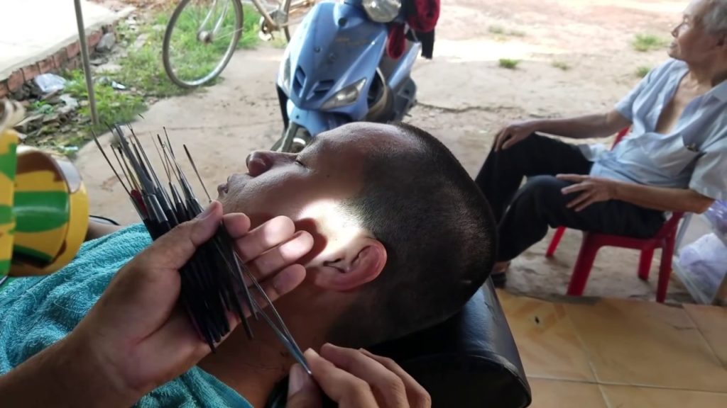 EARS CLEANED AND WAX REMOVAL VIET NAM STYLE AT BABERSHOP