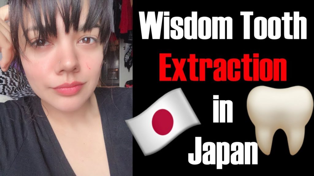 Dentist In Japan: Wisdom Tooth Extraction! No Painkillers & No Laughing Gas!