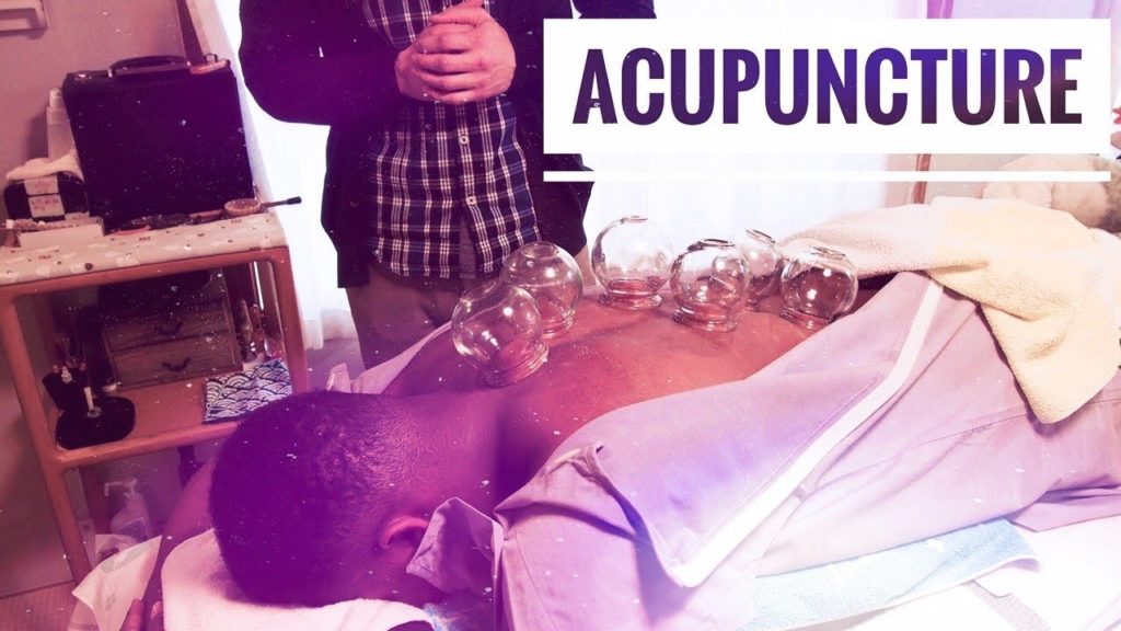 Acupuncture in Kagoshima (Japan)