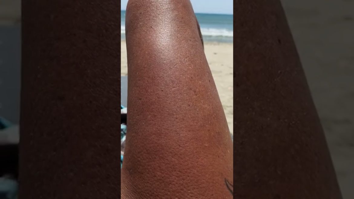 Naked on a Nudebeach