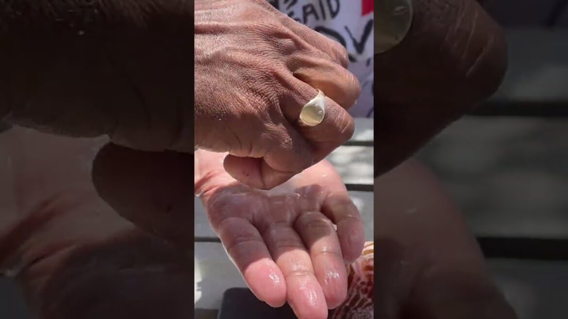 ๐น๐น Eating Poisonous Lionfish SASHIMI RAW SEAFOOD #shorts ๐น๐น Eating Poisonous Lionfish SASHIMI RAW SEAFOOD #shorts