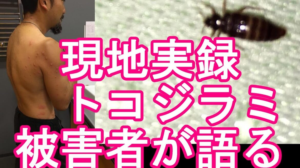 【海外旅行(渡航)時注意喚起】フランスでトコジラミ(南京虫)大量発生で政府が駆除対策へ！ウクライナのオデッサの宿でトコジラミに刺された経験-現地実録動画