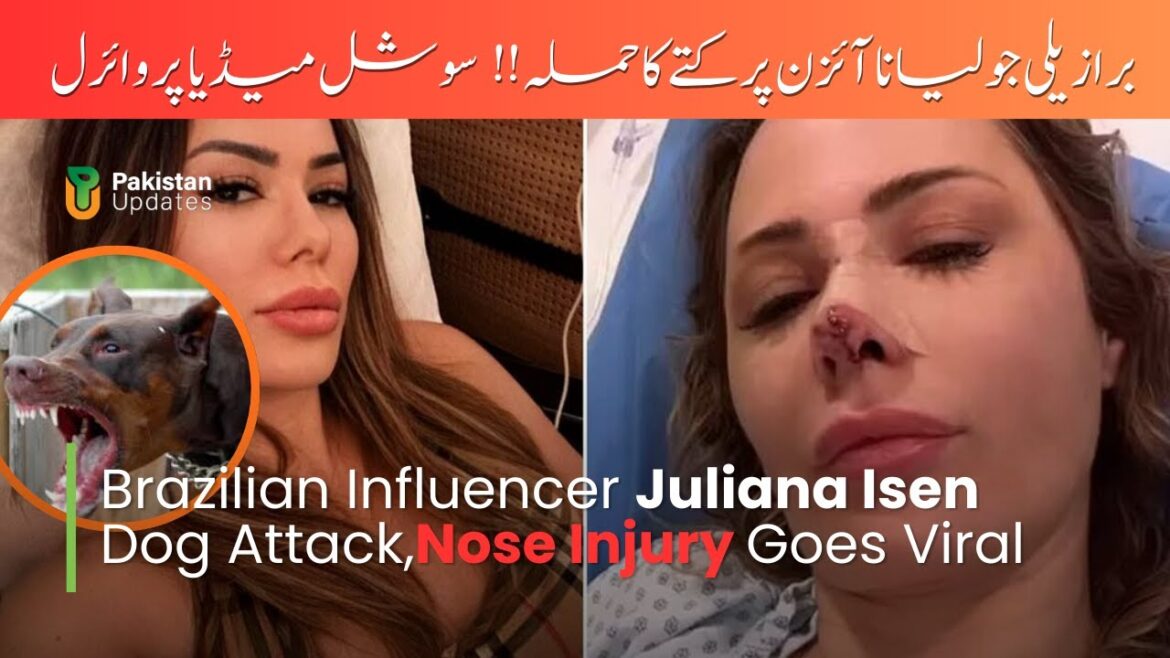 Juliana Isen Terrifying Dog Attack, Her nose bitten off | Pakistan Updates Juliana Isen Terrifying Dog Attack, Her nose bitten off | Pakistan Updates