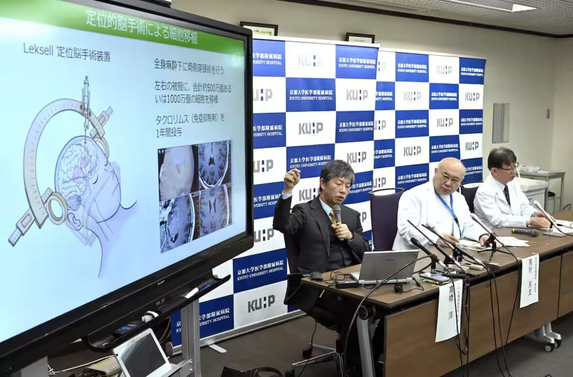 iPS Cell Research Can Give Japan Lead in Regenerative Medicine ips cells