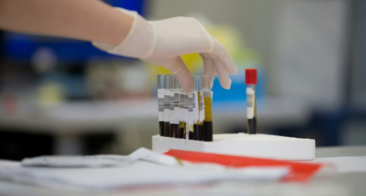 Japan to Begin Clinical Trials for Artificial Blood This Year