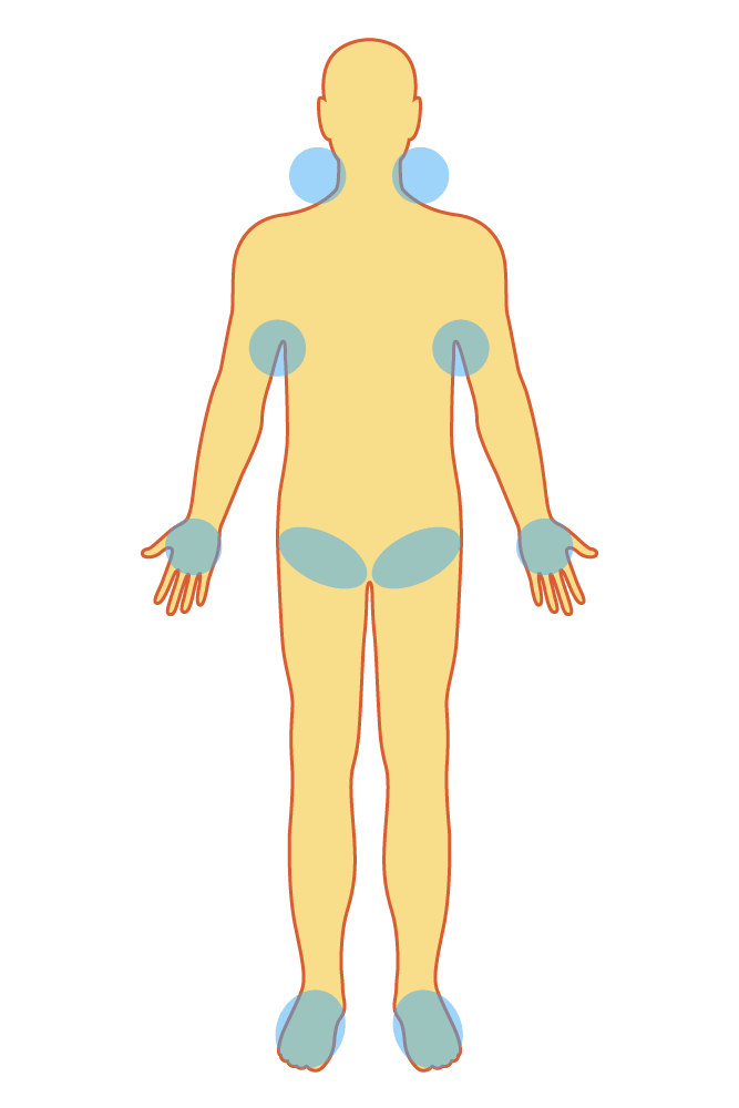 Areas of the body that should be cooled when heatstroke is suspected. (© Nippon.com)