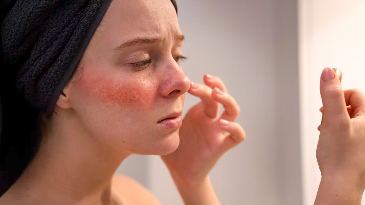 skin-inflammation