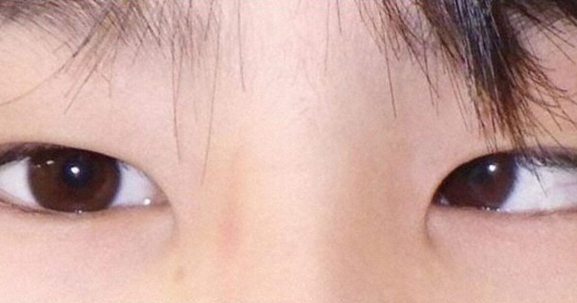 Japan focusing on a fix for device-linked youth eye condition Japan focusing on a fix for device-linked youth eye condition