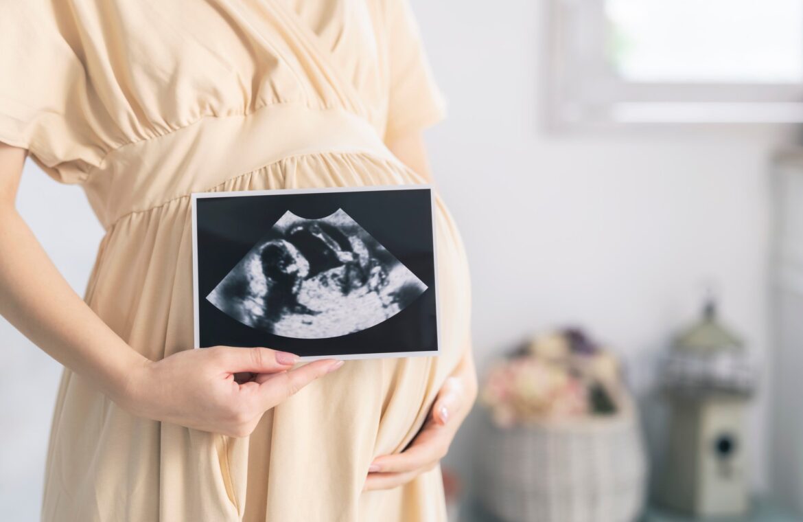 Pregnant woman in a dress holding ultrasound in front of her stomach