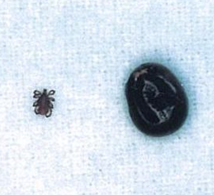 "Risk of Infection Anywhere in Japan"... Tokyo Alarmed by First SFTS-Related Pet Death