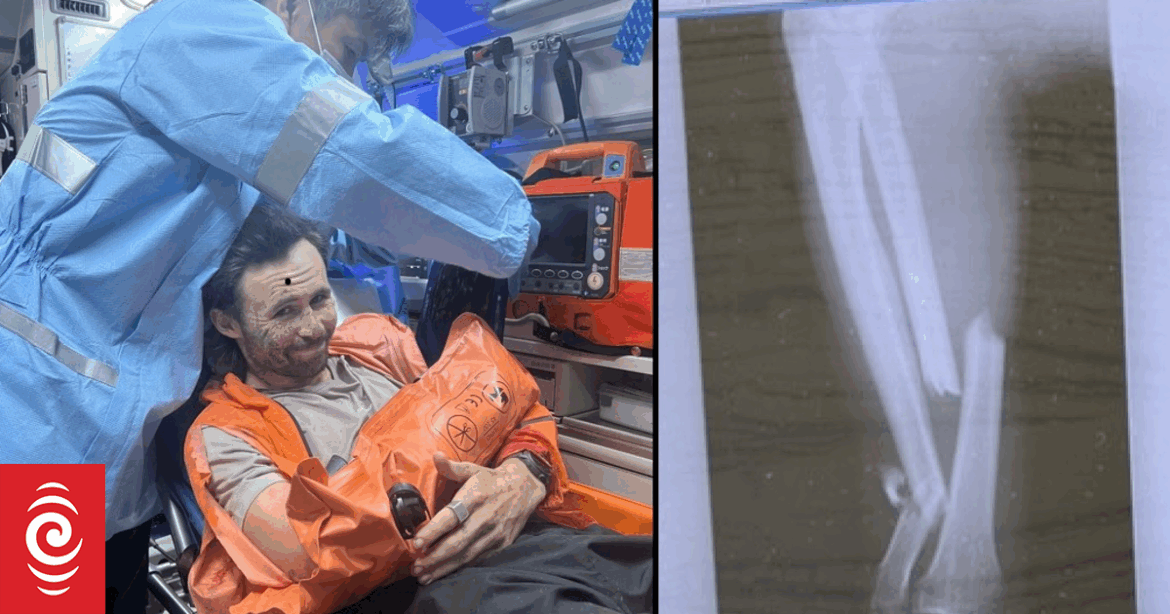 Kiwi’s arm ‘fully snapped’ in Japanese bear attack Kiwi's arm 'fully snapped' in Japanese bear attack