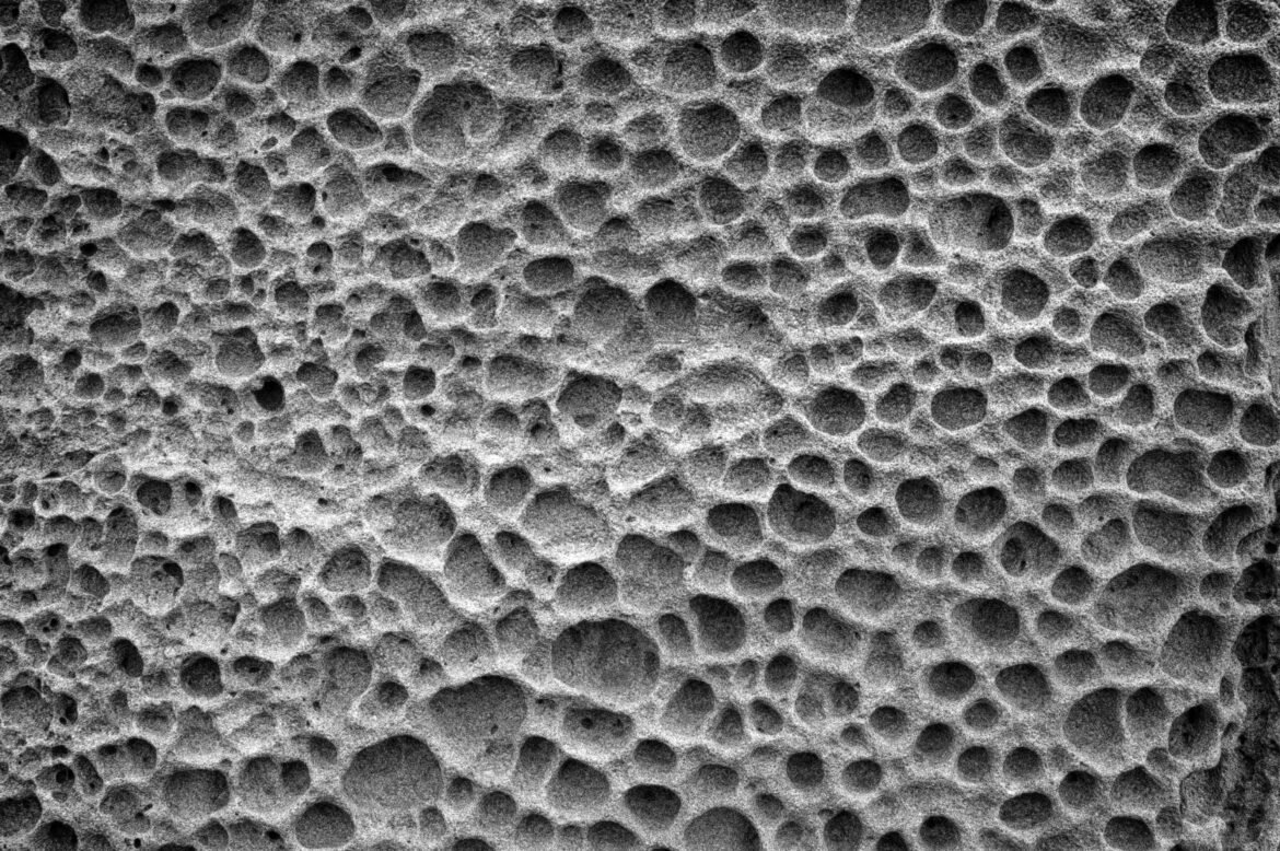 “Porosity”: Connecting 2 Western Cultural Psychiatric Discourses in Tokyo by Way of Naples social determinants of health and mental health