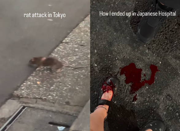 A post released by a tourist walking on the streets of Shinjuku, Tokyo, saying he had been bitten by a rat. [Photo source = Instagram capture]