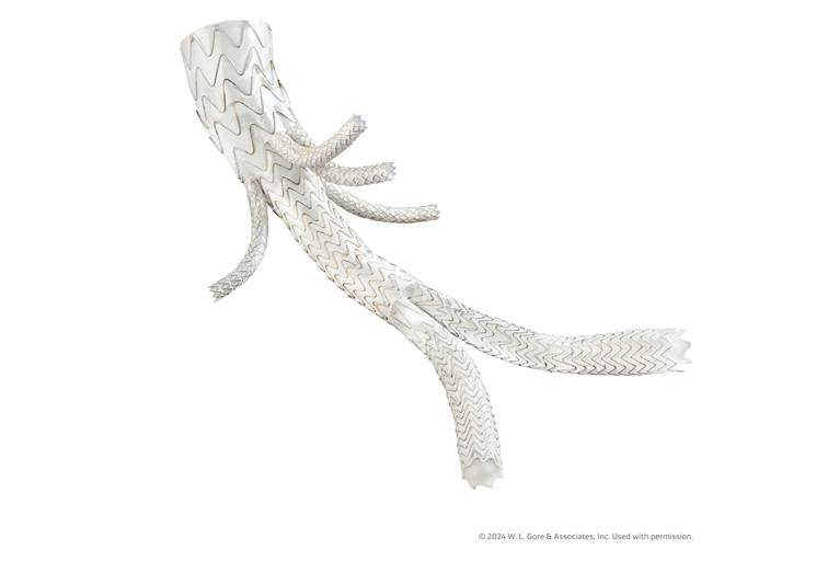 Gore reports first clinical use of TAMBE device in Japan Gore reports first clinical use of TAMBE device in Japan