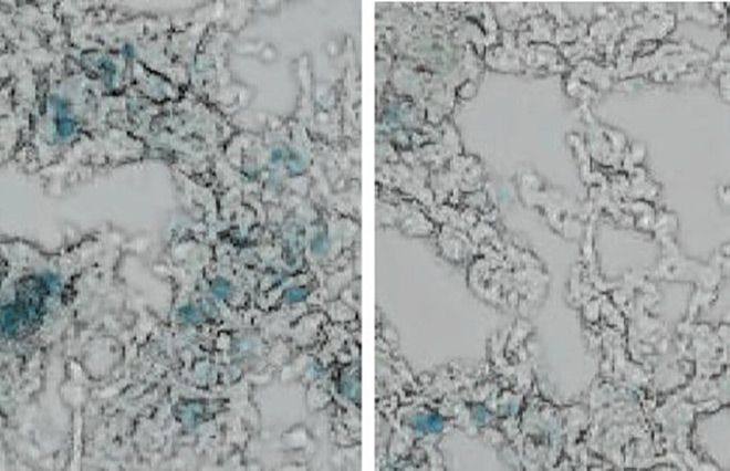 Kyoto team finds drug that kills aging-related cells in mice Photo/Illutration