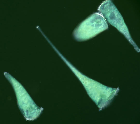Stentor coeruleus. Image credit: Laboratory of Physical Ethology, Hokkaido University.