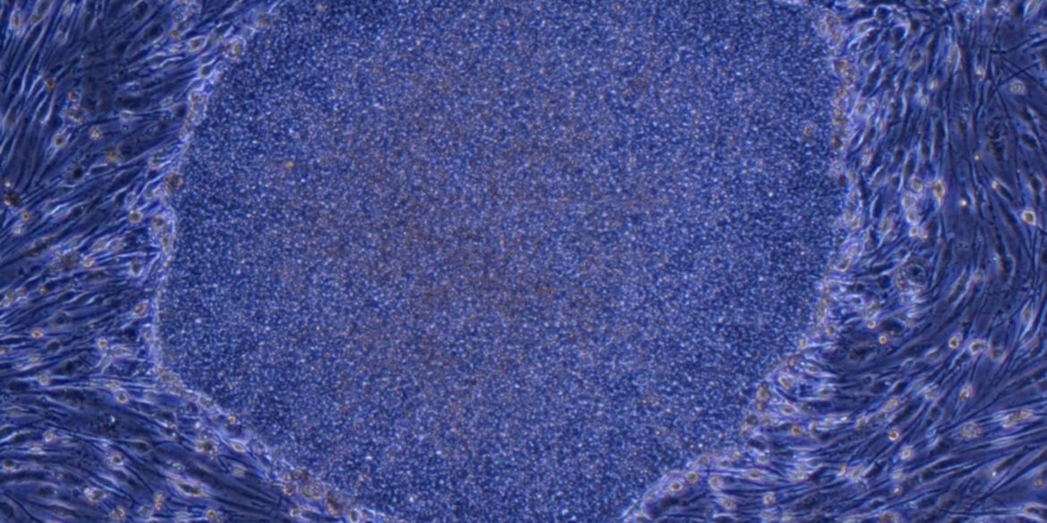 Kyoto University to seek 5-year extension of iPS cell patent Kyoto University to seek 5-year extension of iPS cell patent