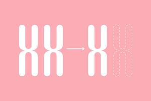 Loss of the X chromosome is associated with reduced chance of natural pregnancy Loss of the X chromosome is associated with reduced chance of natural pregnancy