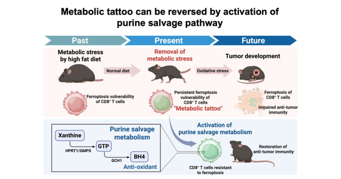 How to remove a metabolic tattoo