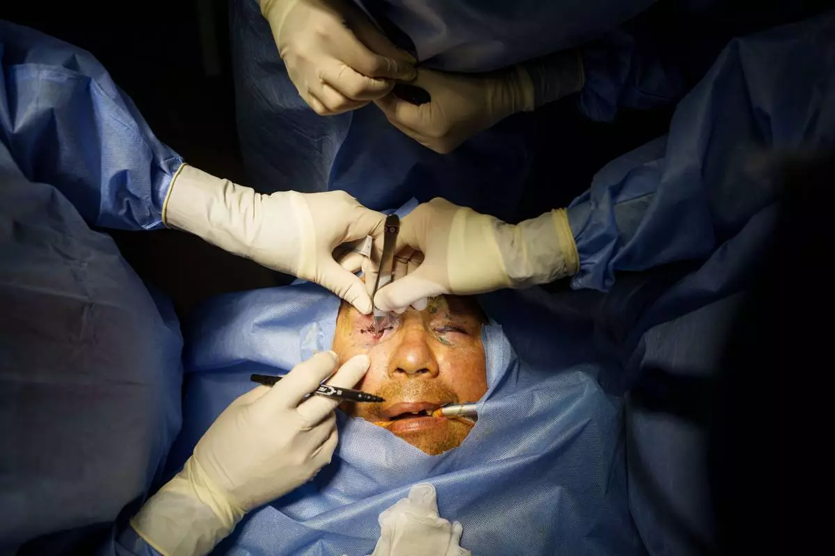 Stuart Seiff, a U.S. oculoplastic surgeon, with Ukrainian colleagues perform surgery on the eye of wounded soldier Mykola Kasiuk at a hospital in Kyiv, Ukraine, Monday, Sept. 28, 2026. (AP Photo/Evgeniy Maloletka)